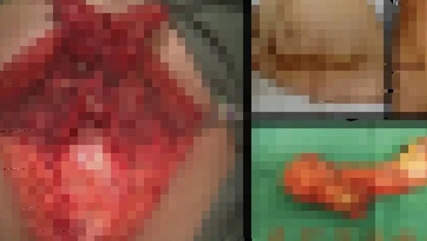 女生身高1米6体重50斤仍要减肥,澳门正版资料免费更新1,国产化作答解释落实_增强版V4.64